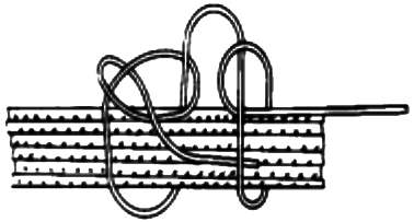 起始線節(jié)的打結(jié) 起始線節(jié)的打結(jié)